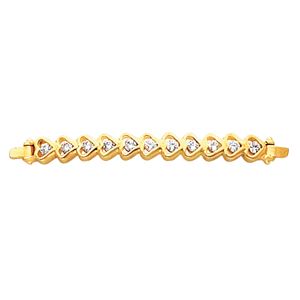 Bracelet Center Mounting